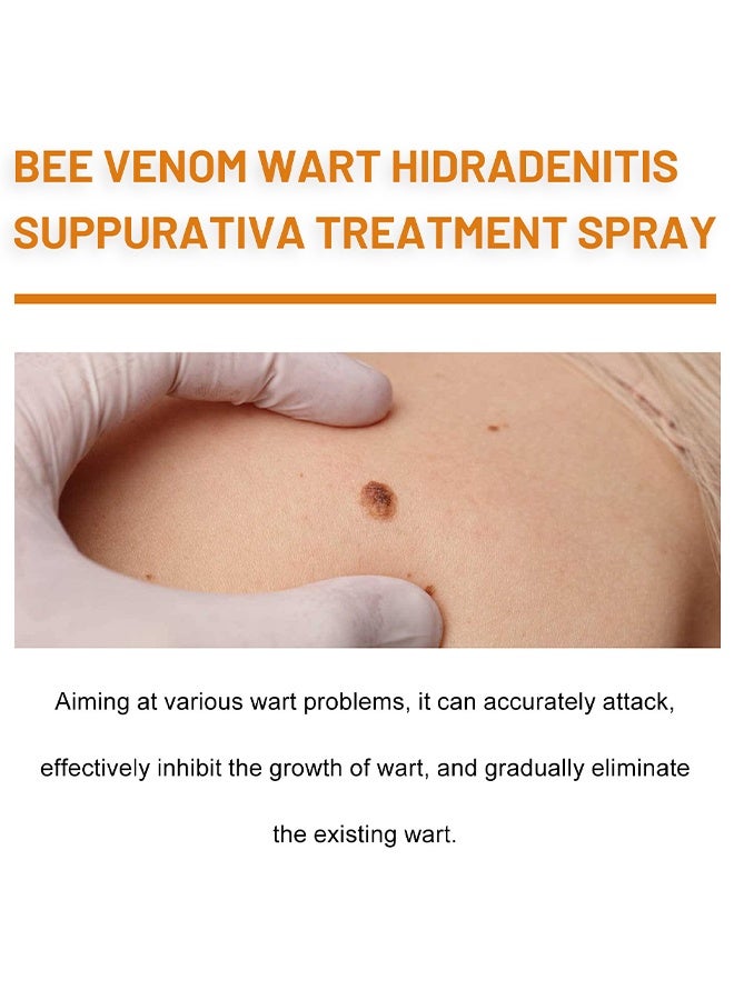 ximonth Bee Venom Wart Removal Spray, Bee Venom Wart Removal Solution, Wart Removal Freezer, Wart Removal Spray, Skin Tag Removal, Painless Removal Of Skin Tags And Moles 20ml - Image 4